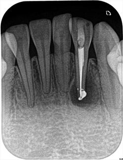 2017.03.18 endo1_R23.jpg
